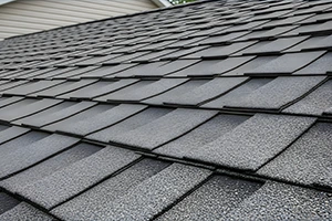 Shingles